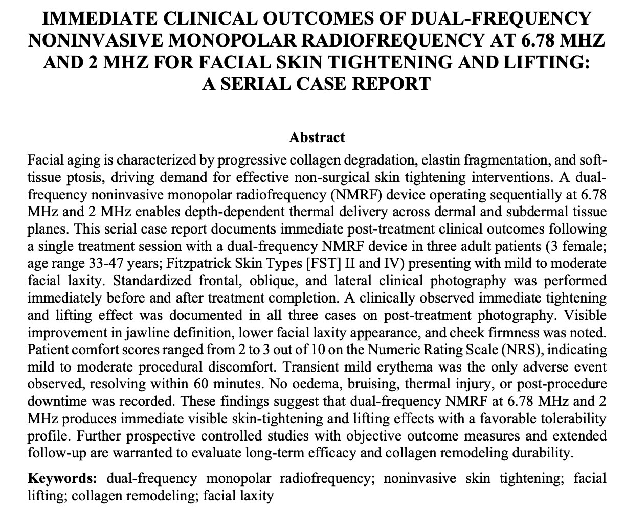 Abstract of the serial case report on dual-frequency monopolar radiofrequency at 6.78 and 2 MHz presented at ARUNA International Summit 2026