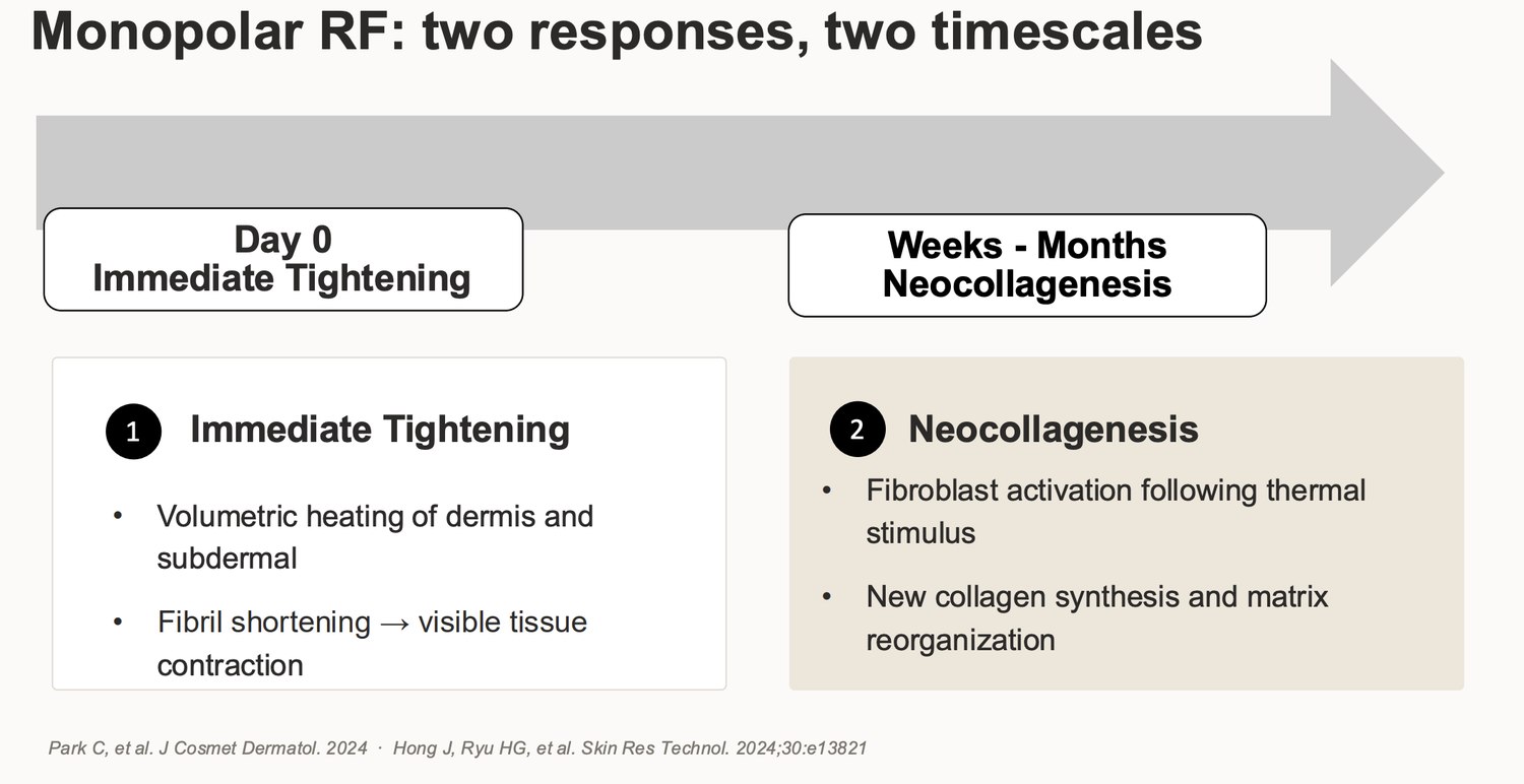 Presentation slide: monopolar radiofrequency produces immediate tightening on day zero and neocollagenesis over weeks to months
